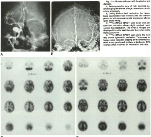 Fig. 2.-39-year-old man with headache and diplopia. 