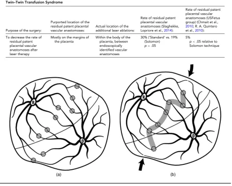 FIGURE 1(a). Selective photocoagulation of communicating vessels (SLPCV). All of the anastomoses are photocoagulated, regardless of their loca-