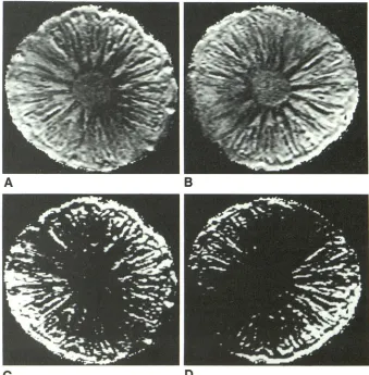 Fig. 4.-Apparent images (500/120) diffusion coefficient (ADC) of a pineapple. There is 