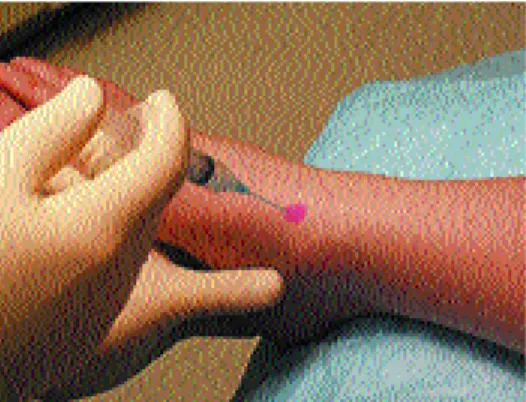 FIGURE 3. Ankle joint injection.