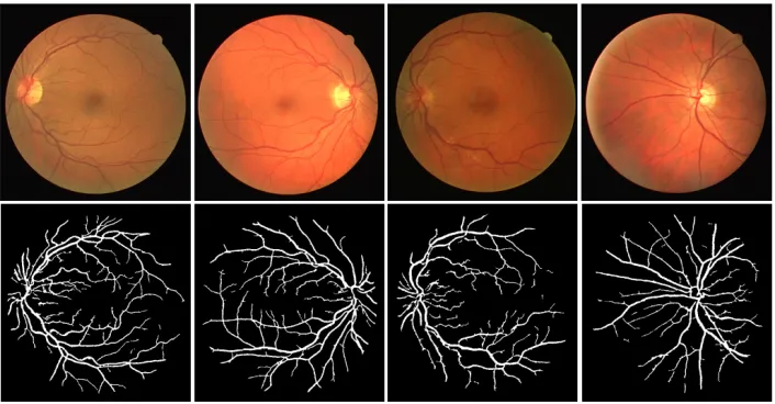 Fig. 9. Retinal blood vessel segmentation using the proposed method. First row shows images fromthe DRIVE dataset, while the second row shows corresponding segmentations obtained by the pro-posed method