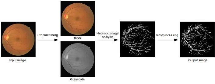 Fig. 1. Overview of the proposed method. The input image was taken from the DRIVE dataset