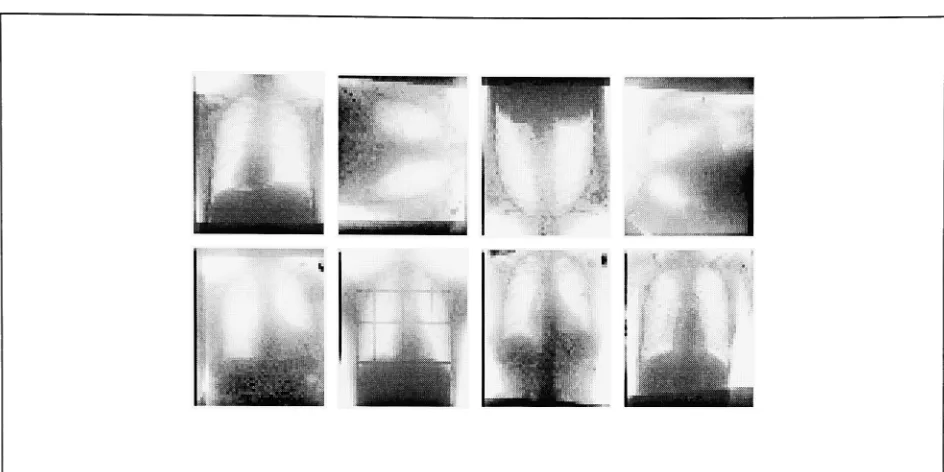 Figure 16: Examples OfChest X-Ray Images (enhanced)