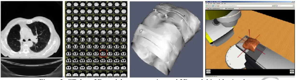 Figure 3. CT data, 3D model reconstruction and 3D model inside simulator 