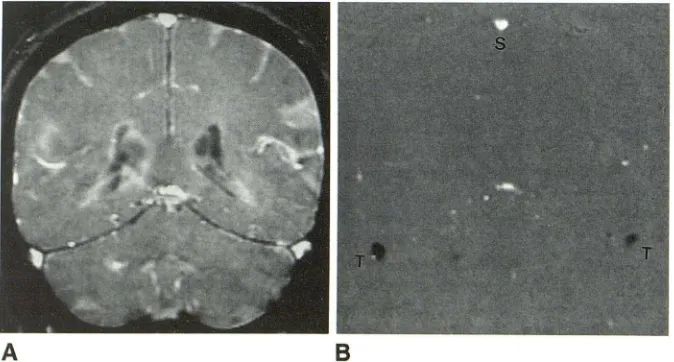 Fig. 1.-Example of VIGRE images of a nor-mal volunteer with acquisition parameters as 
