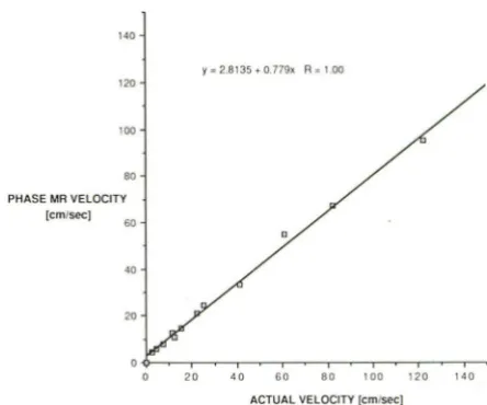 Fig. 2.-ln set with VIGRE sequence. Because vitro comparison between actual and observed flow velocities of velocity range tested, peak velocity was higher than velocity range used in clinical imaging