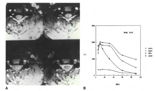 Fig. 1.-Evaluation width and level are kept constant of signal and contrast with a 30FT volume gradient-echo series, 50/15, with varying flip angles at the same anatomic level