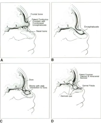 Fig. 16of aberrant · development in .-Schematics illustrating the results the anterior skull 