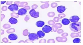 Figure 1 Microscopic Image of Blood 
