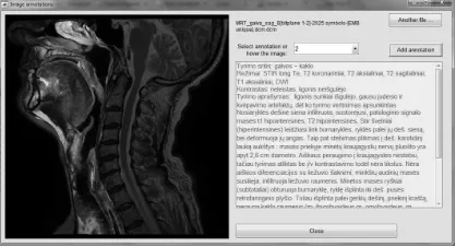 Fig. 3. Presentation of the description for the selected ROI (highlighted) of MRI headimage in the sagittal section