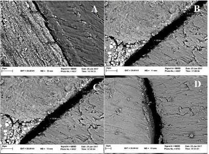 Fig. 1: Scanning electron microscopic micrograph showing the dentin-sealer interface. (A) and (B) indicate the largest and the smallest gaps between the fluoride varnish and dentinal wall, respectively