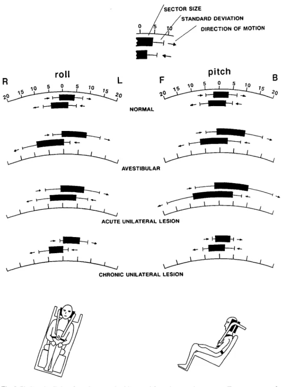 Fig. 2 Pitch and roll data from the normal subjects and from three patient groups. Two sectors, one for each hemicycle, are shown in each example