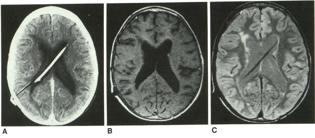 Fig. 4.-Case Gd-enhanced 4. MR 