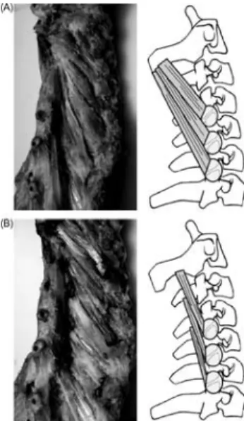 Figure 7 Anatomy of (A) superﬁcial and (B) deep layers of the cervical multiﬁdus muscles, depicting attachments on the facet capsules
