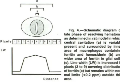 Fig. 4.-Schematic late phase diagram of of resolving hematoma 