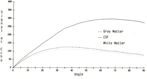 Fig. 2.-Relative 3000/1500/200/1; 50/0matter. Tissue parameters 13. Theoretical contrast curves are given for CSF, signal intensity vs flip angle for FLASH sequence, 50/ gray matter, and white (T1/T2/T2* in msecfrelative spin density): CSF, gray matter, 95