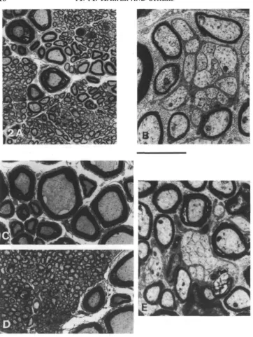 Fig. 2. Electron micrographs of the visceral (A,B) and gill arch (C-E) branches of thevagus nerve trunk from a warm-acclimated carp