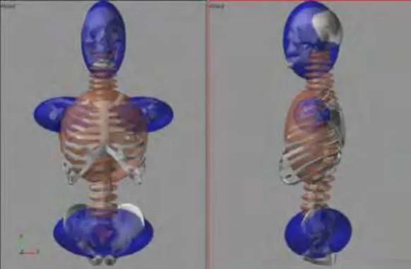 Fig. 11. Front and side view of the  complete discretized spine 