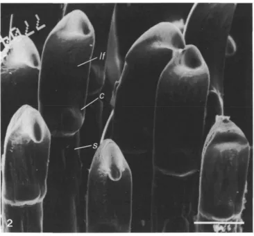 Fig. 2. Scanning electron micrograph of tooth caps (c) from a butterfiyfish showing theconnection with the shaft (s)