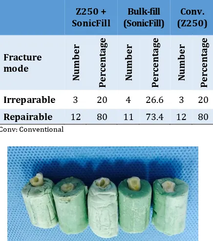 Table 4. Frequency percentage of each fracture type 