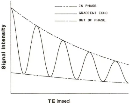 Fig. 2.-Standard imaging, which is independent (TE). how gradient-echo signal varies as sinusoidal function and phase-contrast signal intensities vs echo delay Out of phase represents Dixon spin-echo method of chemical-shift of TE