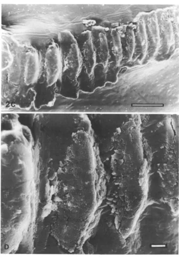Fig. 2. (C) Appearance of file after 5 weeks of singing, note deposits around file. Scalebar, 100/on