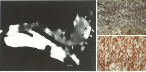 Fig. lobe compared with abundant red-staining lipid material in B, Oil Red MR 0 stain of anterior (top) and posterior (bottom) posterior lobes at x100 = intensity bone