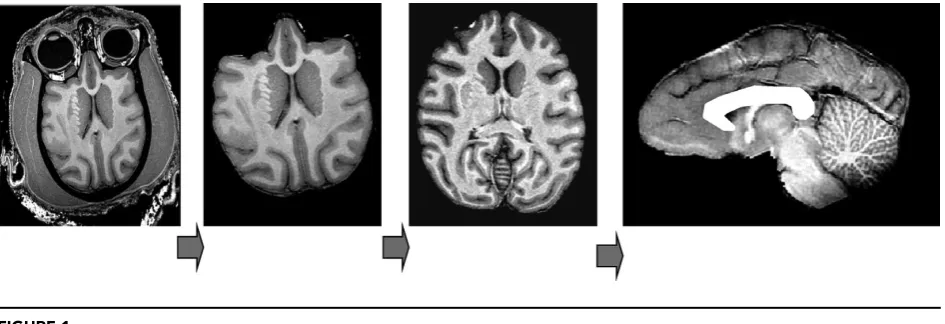 FIGURE 1Structural image processing pipeline, which allows for a simple automation of sequential processing steps