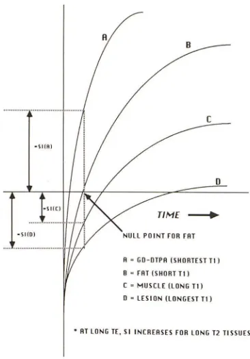 Fig. 5.-Effect A, on contrast of changes in TI. Axial STIR image, 2500/200/20. 