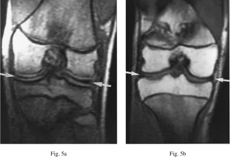 Fig. 5a Fig. 5b
