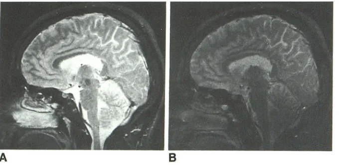 Fig. 1.-window uous and 2000/70, 5-mm T2-weighted cardiac-gated images, slice thickness