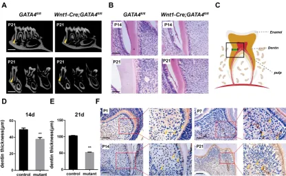 Figure 1. Wnt1-Cre;GATA4Tooth root dentin abnormalities in Wnt1-Cre;GATA4fl/fl mice. (A) Micro-CT showing short roots and dentin defects in the mandibular molars of fl/fl mice at postnatal day 21 (P21) (Bar: 300 μm)