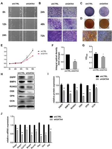 Figure 4. Effect of GATA4 on migration, proliferation and odonto/osteogenic differentiation of DPSCs