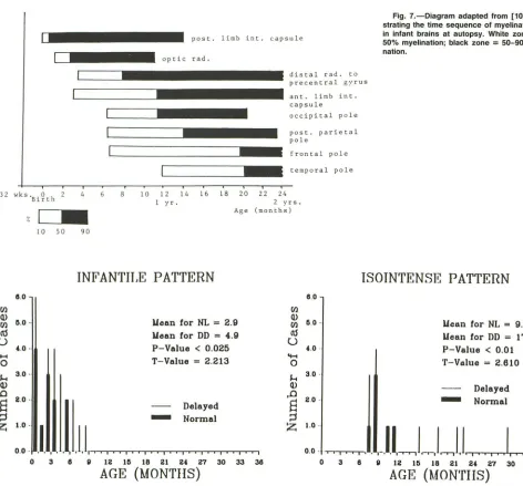 Fig. 7.-Diagram 50% in strating infant adapted from [10] demon-the time sequence of myelination seen brains at autopsy