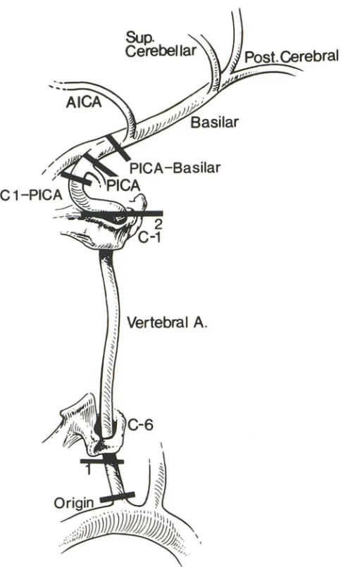 Fig. 1.-Division origin; (5) PICA origin; (6) PICA origin of first C6; (3) anatomic of vertebral artery into six parts: (1) origin, (2) anatomic segment-from origin to entry of vertebral into foramen transversarium second segment-foramen of C6-C1; (4) C1 t