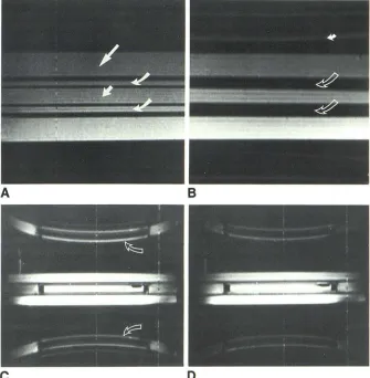 Fig. 2.-Pulsation spine phantom. All pulse sequences had flow phenomena, sagittal TR 2000 