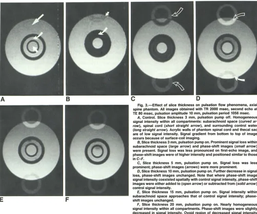 Fig. 3.-Effect spine phantom. All images obtained with of slice thickness on pulsation flow phenomena, axial TR 2000 msec, second echo at 