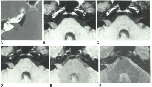 Fig. 7.image-contrast = = were as -SNR and curves fQr tumor patients. SNR curves expected except for drop-off at TR 1000, NEX 6