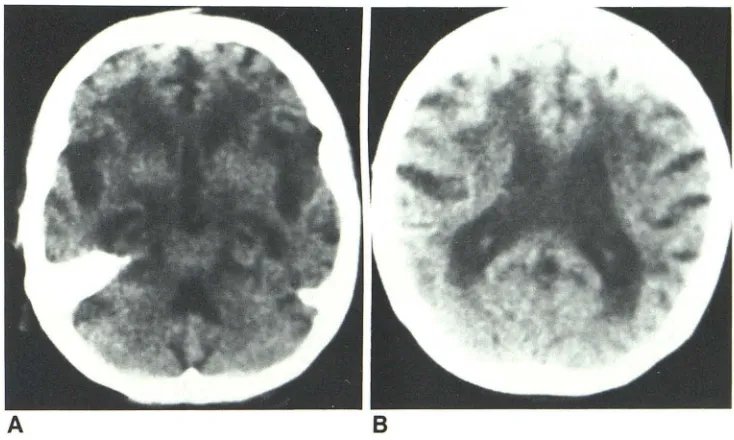 TABLE 5: Neuropathology Cases 