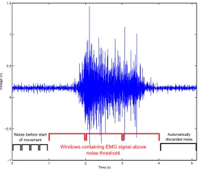 Fig. 5. A raw EMG signal recording with four 256-sample-windows used for determingthe noise RMS and 1024-sample-windows for comparing the signiﬁcant and ineffectualsection.