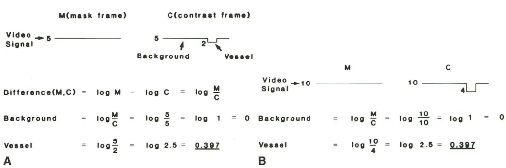 Fig. 5.-Calculations for two different X-ray exposures. A. mAs, ; B. mAs2 (= 2 mAs,). Change in mAs does not affect DSA density measurements