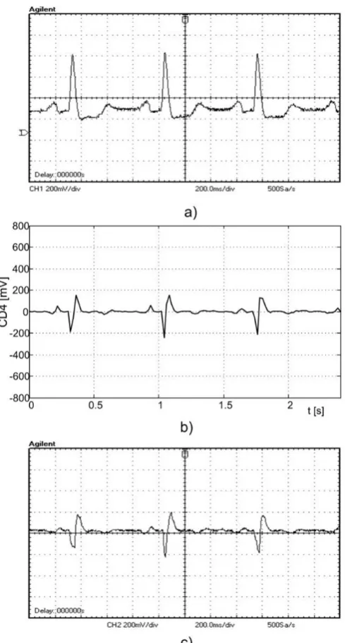 Fig. 7. FST calculated by MATLAB, off-line, and by MSP430F169, on-line. a) the oscillograph of the original ECG signal, b) CD4(n) coefficients plotted by MATLAB, c) oscillograph of CD4(n) coefficients, recorded on P6.7 pin