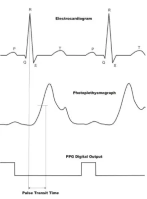 Fig. 2. PTT illustration. RR is time interval between two R peaks in the ECG 