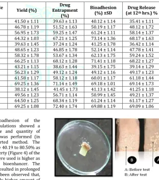 Table 4: Evaluation Parameters for Pyrazinamide and Ethambutol Microspheres using Modified Emulsion and Complex Coacervation Method 