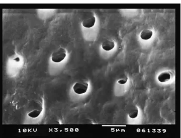FIGURE 6 - SEM of a specimen from the 15% EDTA-T group showing a root surface without smear layer, with the dentinal tubules opened (score 1)
