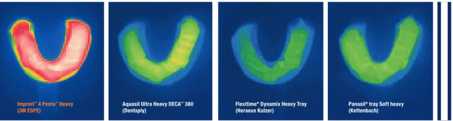 Fig. 8 shows that only Imprint 4 VPS impression material  displays a significant temperature increase, compared to  competitive VPS materials.