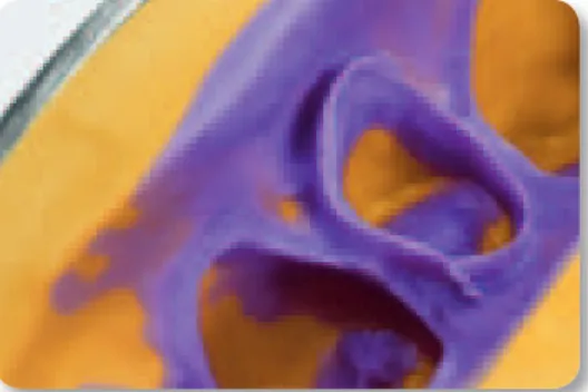 Fig. 17: Accurate and detailed impression of the situation. Impression  made with Imprint ™  4 Penta ™  Super Quick Heavy and Imprint ™  4 Super  Quick Light Material in the 1-step technique