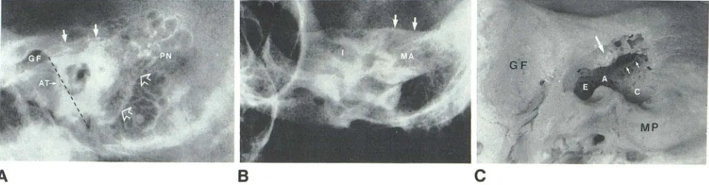 Fig. 4.-eoronal sa from posterior to anterior. A, Section through central tract {el. F sections through right posterior temporal bone of dry skull = facial cells; = squamosal; T = tegmental cells
