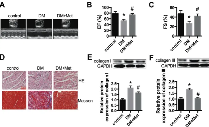 Figure 1. Cardiac function and morphology in diabetic mice treated with or without metformin