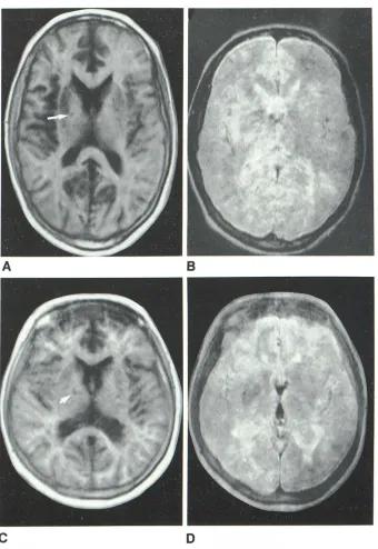TABLE 4: Ability by Scan Technique to Identify Discrete Lesions 